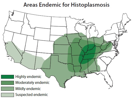 Map of Histoplasmosis