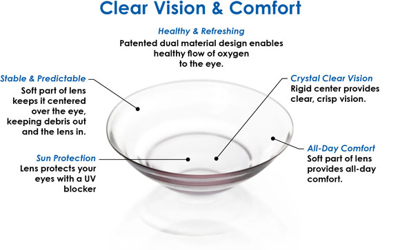 Hybrid Contact Lens